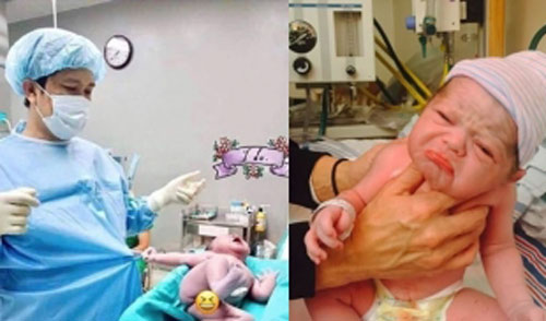 Những bé sơ sinh vừa chào đời đã có biểu cảm "khó đỡ" khiến cả ê-kíp đỡ đẻ cũng phải bất ngờ