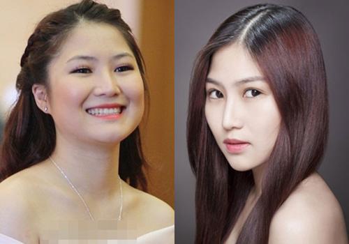 Không chỉ thích cằm nhọn Vline, những sao nữ Vbiz còn thích thẩm mỹ bộ phận này trên cơ thể