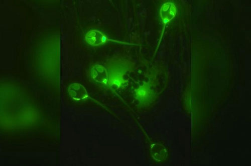 Các nhà khoa học đã phát hiện ra con vật đầu tiên không cần oxy để sống. Điều đó đang thay đổi định nghĩa về một con vật có thể là gì?