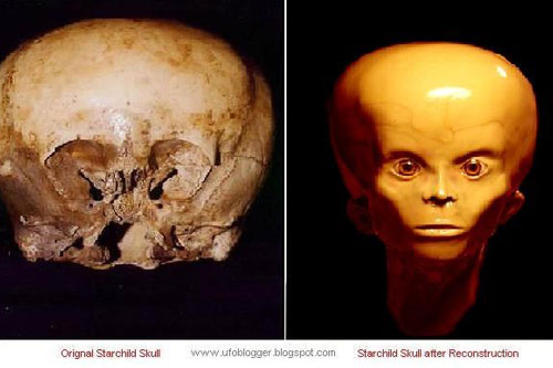 Cận cảnh hộp sọ nghìn tuổi của... người ngoài hành tinh