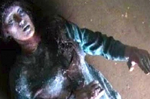 Kỳ lạ: Cô gái hồi sinh sau một đêm bị đóng băng khiến y học không thể lý giải