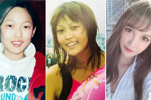 Mẫu nữ phẫu thuật thẩm mỹ từ năm 14 tuổi