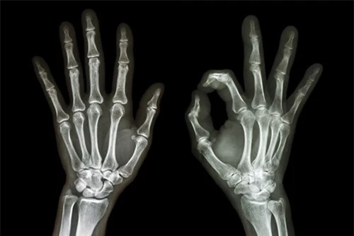 Bàn tay loài người nguyên thủy hơn so với tinh tinh - 1