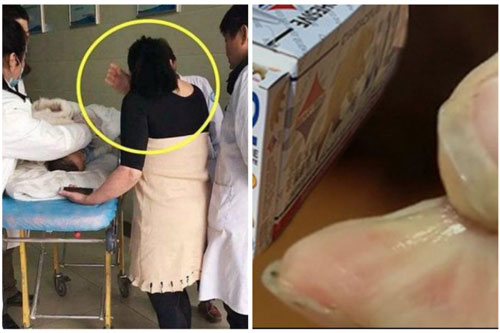 Bé 2 tuổi uống nhầm keo 502, mẹ thông thái cứu con thoát khỏi nguy hiểm trong gang tấc