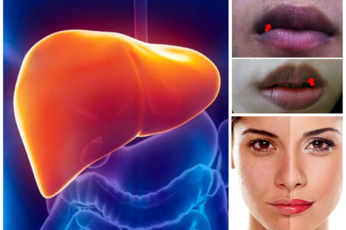 Thấy 4 bộ phận này chuyển màu đen hãy nhanh chóng đi khám ngay kẻo hỏng gan lúc nào không biết