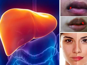 Thấy 4 bộ phận này chuyển màu đen hãy nhanh chóng đi khám ngay kẻo hỏng gan lúc nào không biết