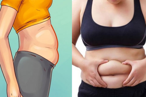 Ba kiểu béo bụng không phải do tăng cân mà là lời "ngầm báo" căn bệnh rất dễ mắc phải