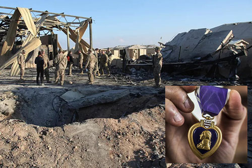 Bị Iran tấn công tên lửa, 110 lính Mỹ sốc nặng, cấp cứu khẩn và được... thưởng huy chương?