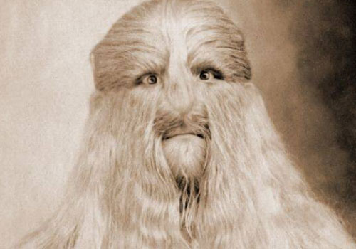 Câu chuyện cuộc đời đầy bí ẩn về người đàn ông có biệt danh "Người có khuôn mặt sư tử"