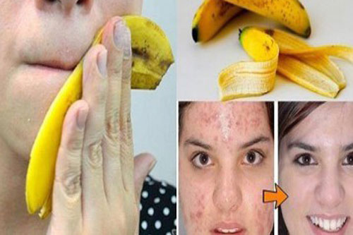 Nếu như biết được công dụng làm đẹp thần kỳ của vỏ chuối chắc chắn bạn sẽ không bỏ nó đi