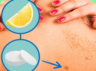 Bài thuốc tại nhà: Cách trị đốm đen trên da hiệu quả