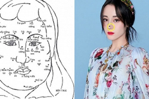 5 nốt ruồi trên mặt báo hiệu phụ nữ tình duyên lận đận, dễ "2 lần đò", xóa càng sớm càng tốt