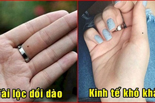 Phụ nữ có nốt ruồi ở ngón tay chú ý: Ngón giữa lộc phúc đủ đầy nhưng ngón út hãy dè chừng điều này