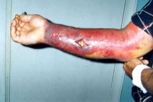 Chính tổ tiên loài người đã góp phần đưa một căn bệnh cực kỳ nguy hiểm lan ra toàn thế giới