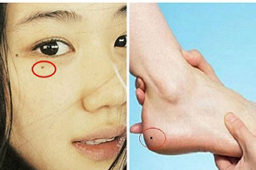 Những nốt ruồi mọc chỗ này dễ khiến cuộc đời bạn long đong, cô độc, hãy tìm cách hóa giải trước khi quá muộn