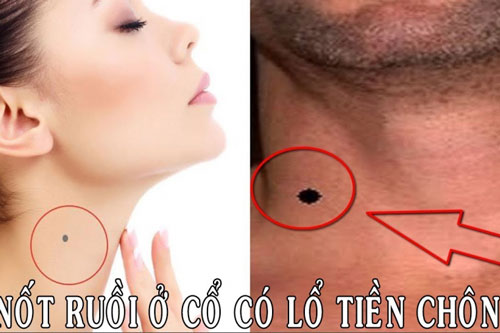 3 vị trí nốt ruồi ở cổ "đắc lộc đắc tài", phú quý song toàn có thể hưởng phúc trọn đời