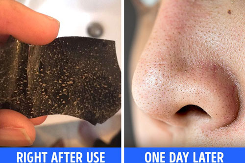 6 điều nên biết trước khi lột mụn đầu đen