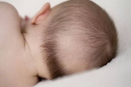 Rụng tóc ở trẻ nhỏ có phải biểu hiện trẻ bị suy dinh dưỡng hay không?