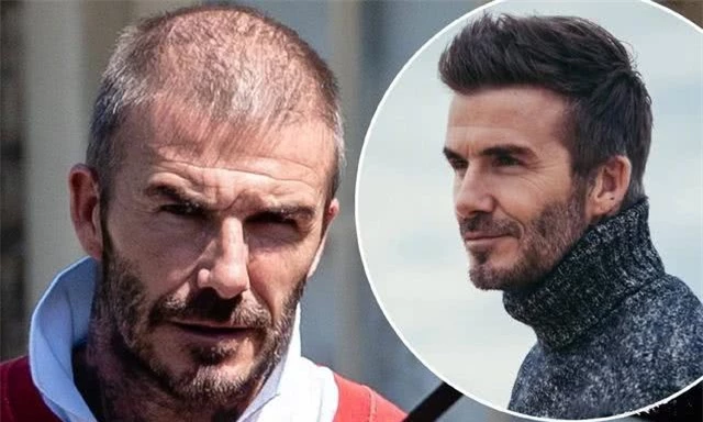 David Beckham đối mặt với chứng rụng tóc và tuổi tác - 1