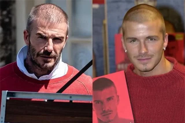 David Beckham đối mặt với chứng rụng tóc và tuổi tác - 5