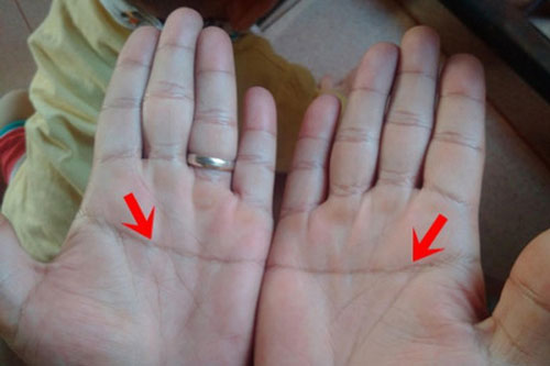 "Điểm vàng" trên bàn tay báo trước tài lộc, thần Tài đỡ đầu, thần May Mắn bảo vệ