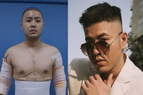 Hình ảnh hiện tại của Akira Phan sau khi 'đập mặt', hút mỡ để 'níu kéo hào quang'