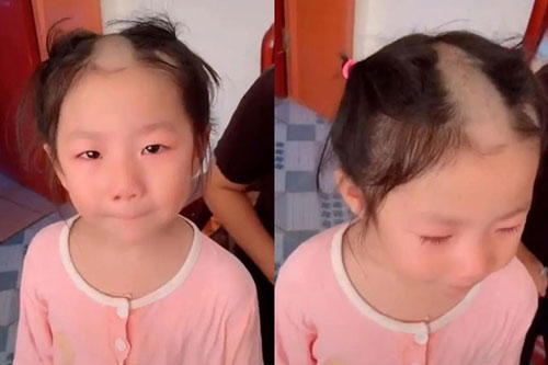 Học cắt tóc theo trên mạng, bé gái dùng tông đơ cạo ngay một đường thẳng tắp trên đỉnh đầu