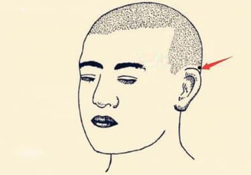 Nốt ruồi tài lộc là gì? Ở những vị trí nào trên cơ thể của bạn có nốt ruồi tài lộc