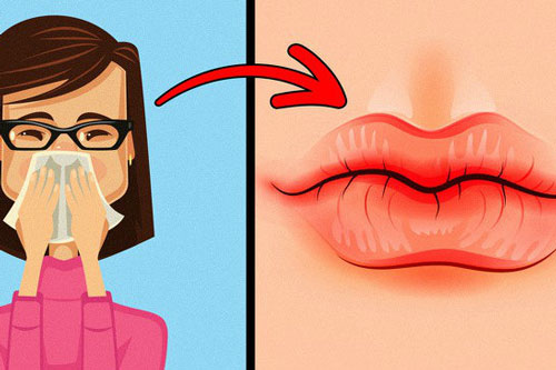 Thấy môi có dấu hiệu này, hãy nhanh chóng đi gặp bác sĩ ngay kẻo căn bệnh nguy hiểm đang 'gõ cửa'