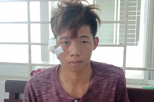 Bà Rịa - Vũng Tàu: Nghi án đâm chết bạn vì bị cắt tai