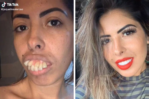 Chỉnh sửa hàm răng xấu, cô gái khiến dân cư mạng TikTok "choáng" với diện mạo mới trước khi tự "vạch mặt" chính mình