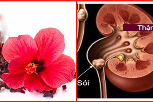 Loài hoa mọc dại ven đường nhưng ít ai biết nó có thể "đánh bay" sỏi thận