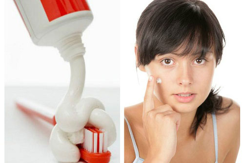 Bôi kem đánh răng lên mặt theo cách này, bao nhiêu mụn cũng biến mất mà da lại trắng hồng rạng rỡ