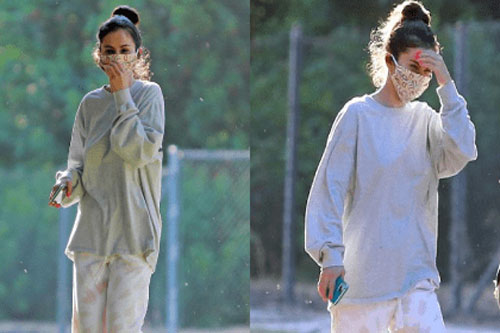 Selena Gomez sụt cân sau một thời gian tiết lộ bị bệnh rối loạn lưỡng cực