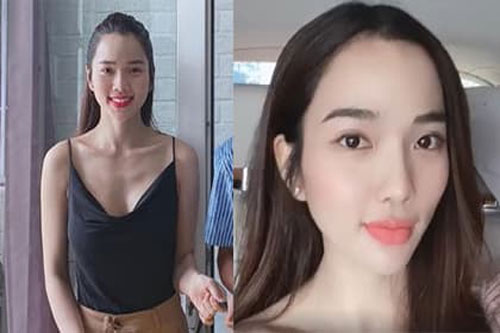 Vợ Ưng Hoàng Phúc bị soi gầy trơ xương, nhan sắc khác lạ sau tiêm filler vào môi