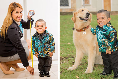 Người đàn ông lùn nhất hành tinh 34 tuổi cao hơn 72 cm