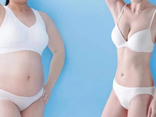 Hướng dẫn chị em 3 cách giúp da bụng trở nên mịn màng, săn chắc hơn sau khi sinh mổ