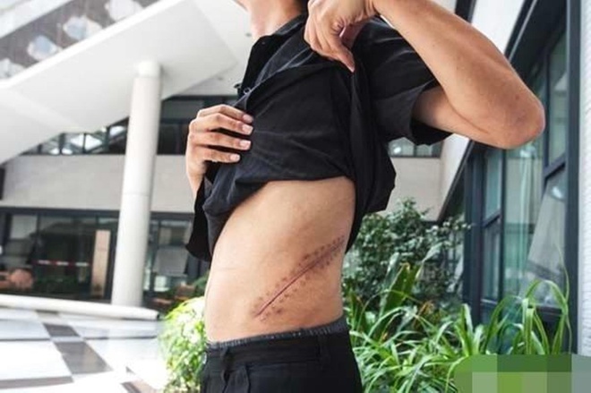 Chàng trai bán thận để mua iPhone 4 chín năm trước giờ ra sao