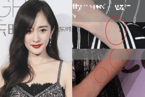 Xôn xao loạt hình ảnh Dương Mịch lộ sẹo dấy lên nghi vấn tự cắt cổ tay, ngược đãi bản thân