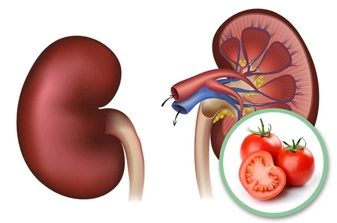 9 tác dụng phụ khi ăn quá nhiều cà chua, điều số 8 nguy hiểm nhất có thể mất mạng - 5