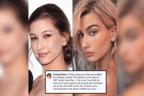 Bị nghi đụng dao kéo, kém xa Selena Gomez, vợ Justin Bieber phẫn nộ tuyên bố ngay một câu