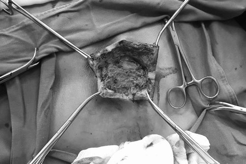 C&#x1EA3;nh b&#xE1;o: Than - B&#x1EC7;nh c&#x169; &#x111;&#xE1;ng s&#x1EE3; &#x111;ang quay l&#x1EA1;i