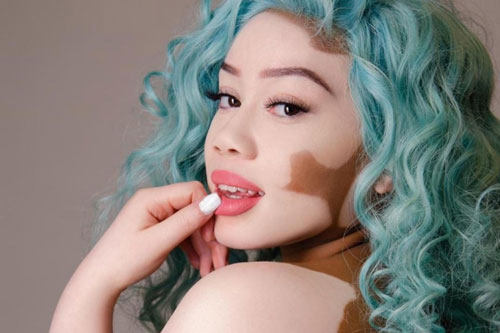 Nữ người mẫu từng bị ví như "bò sữa" ngày càng nổi tiếng