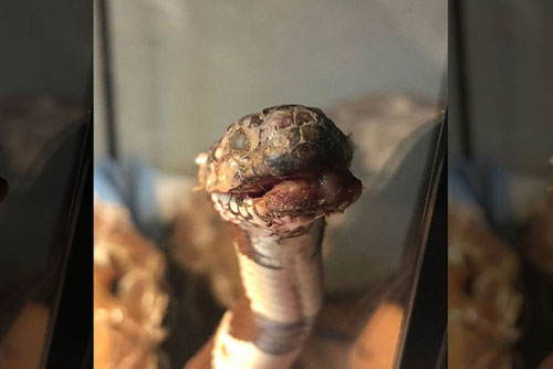 Bệnh hiếm biến rắn trông giống như… “xác ướp”