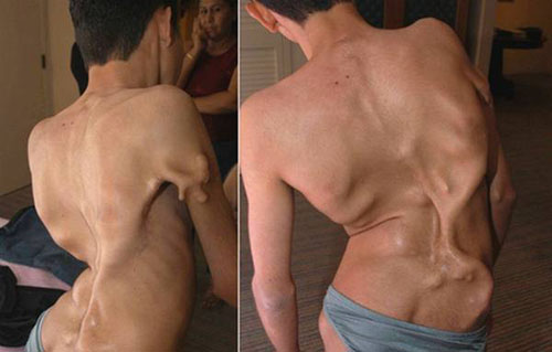 Điểm danh 14 căn bệnh kỳ lạ nhất trên thế giới