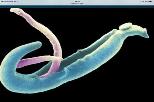 Điểm mặt 4 con "quái vật" trong cơ thể bạn