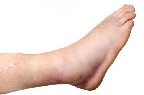 7 bệnh nguy hiểm bạn sẽ mắc phải khi ăn nhiều đồ ngọt mỗi ngày