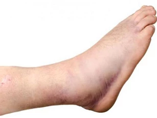 7 bệnh nguy hiểm bạn sẽ mắc phải khi ăn nhiều đồ ngọt mỗi ngày
