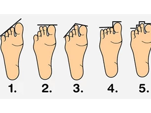 Trắc nghiệm: Độ dài ngón chân bật mí cá tính của bạn