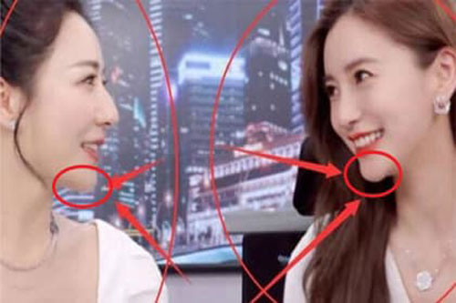 Cứ khăng khăng không thẩm mỹ, Angelababy vẫn bị soi chiếc cằm dị thường trong cùng khung hình với người đẹp khác